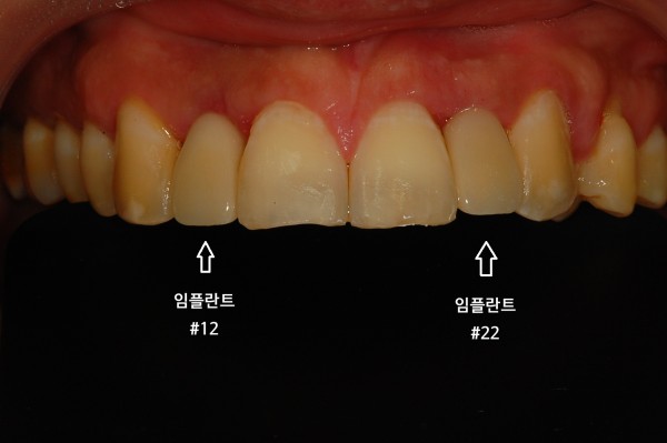 da60a3c2fa21e82f132b0b5d908e620d_1778203309_952.jpg